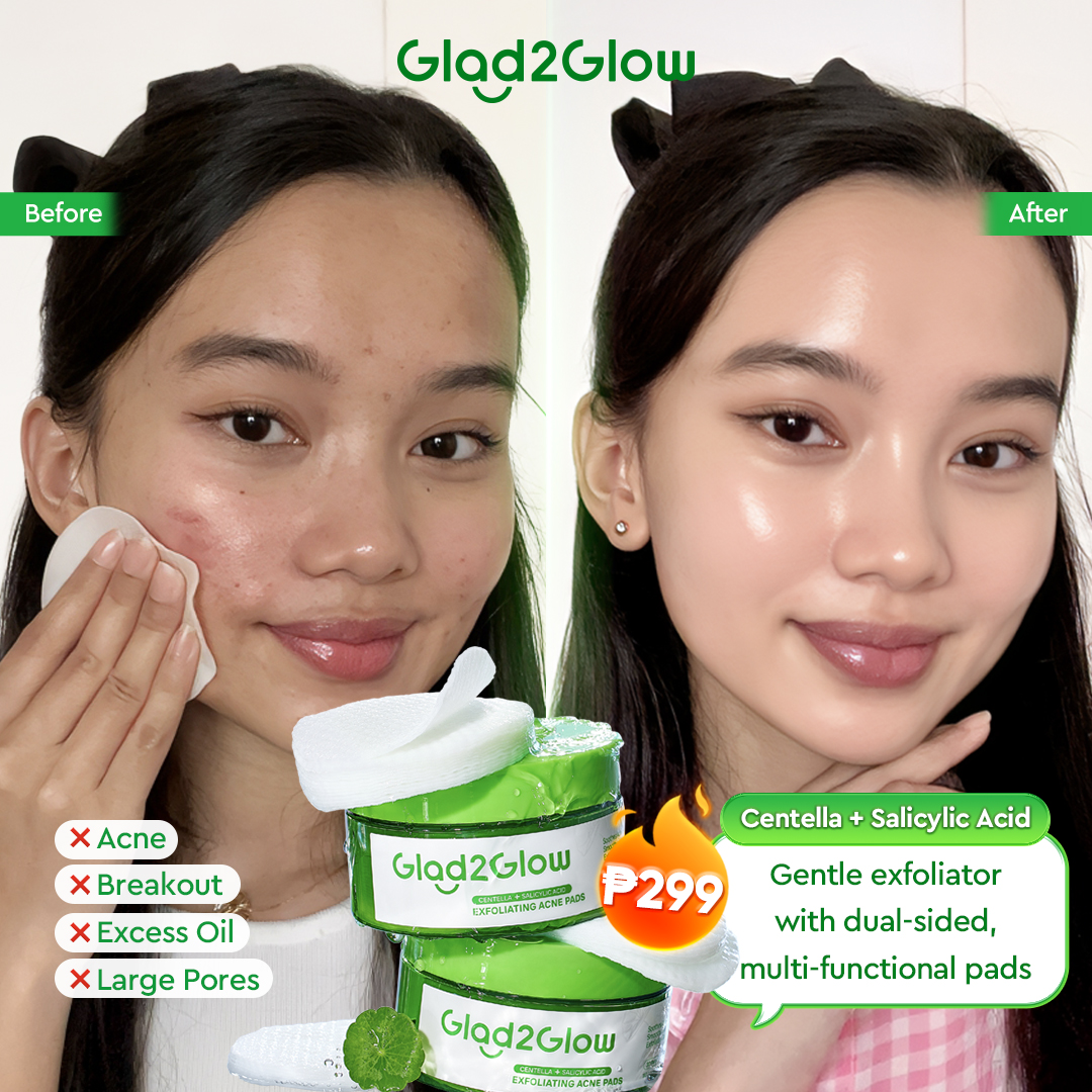 Glad2Glow'Philippines Facebook ad