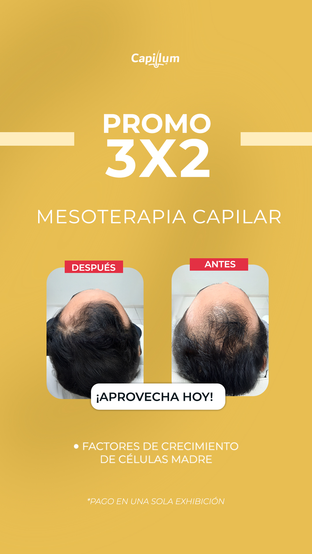 Capillum Facebook ad
