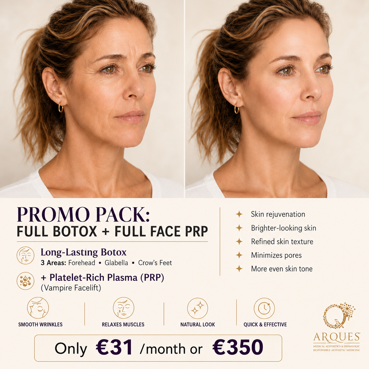 Arques Clinic Marbella Facebook ad: EXCLUSIVE SUMMER OFFERS | Save up to 75%
