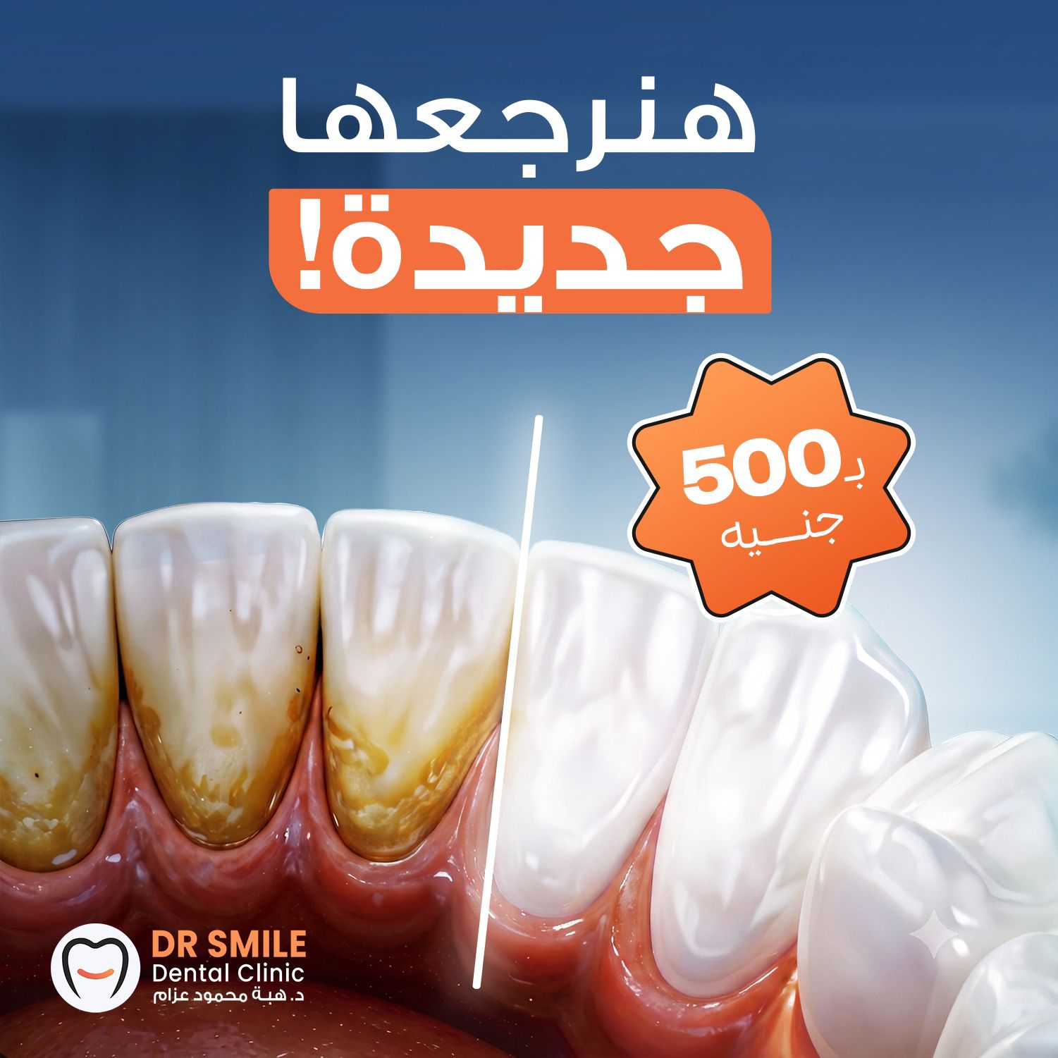 Dr Smile Dental Clinic د/ هبة محمود عزام Facebook ad: تنظيف اسنانك + تلميع + كشف = 500…