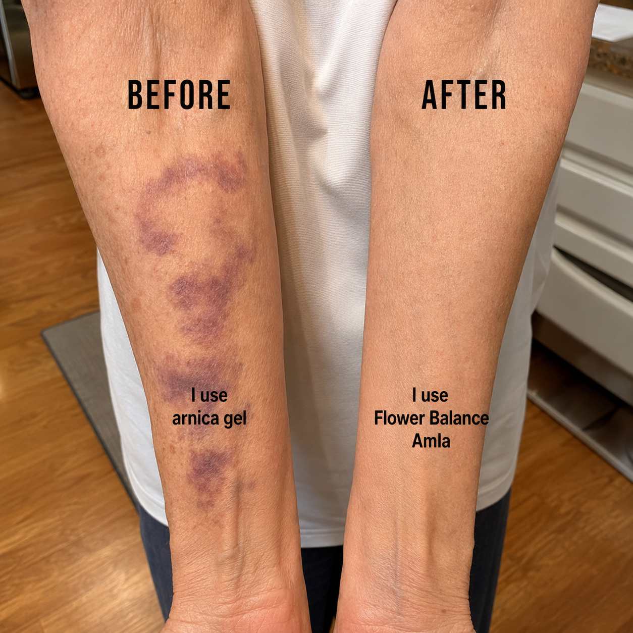 Jessica Palmer Facebook ad: I've Treated Unexplained Bruising in Women Over 60 for 19…