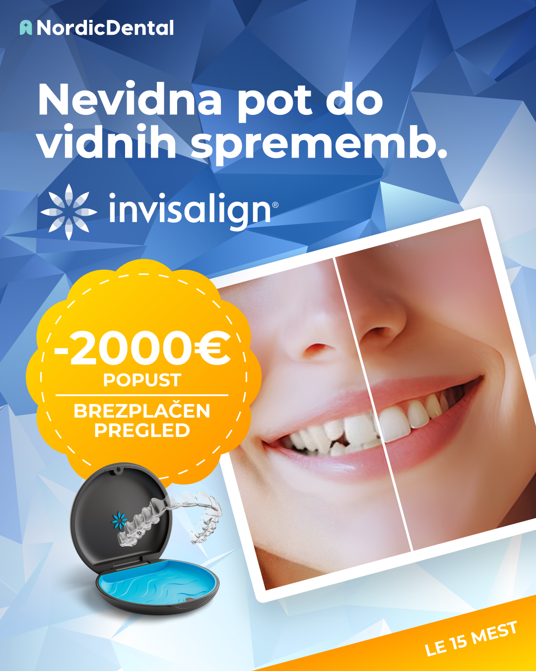 Nordic Dental Facebook ad