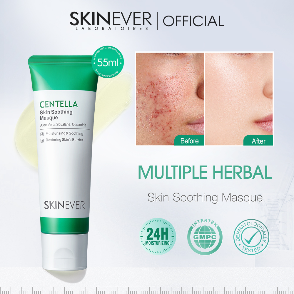 Skinever ph Facebook ad