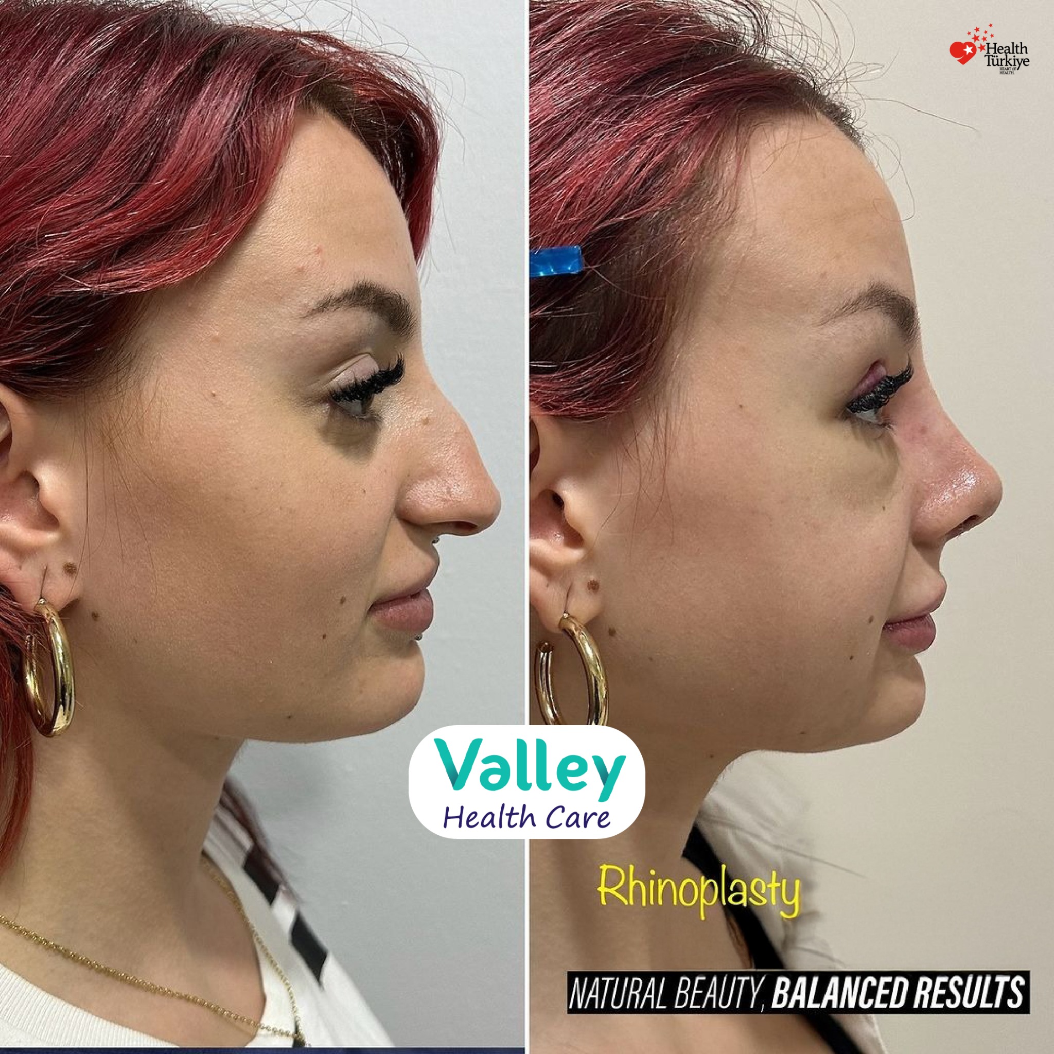 Valley Clinic Turkey Facebook ad