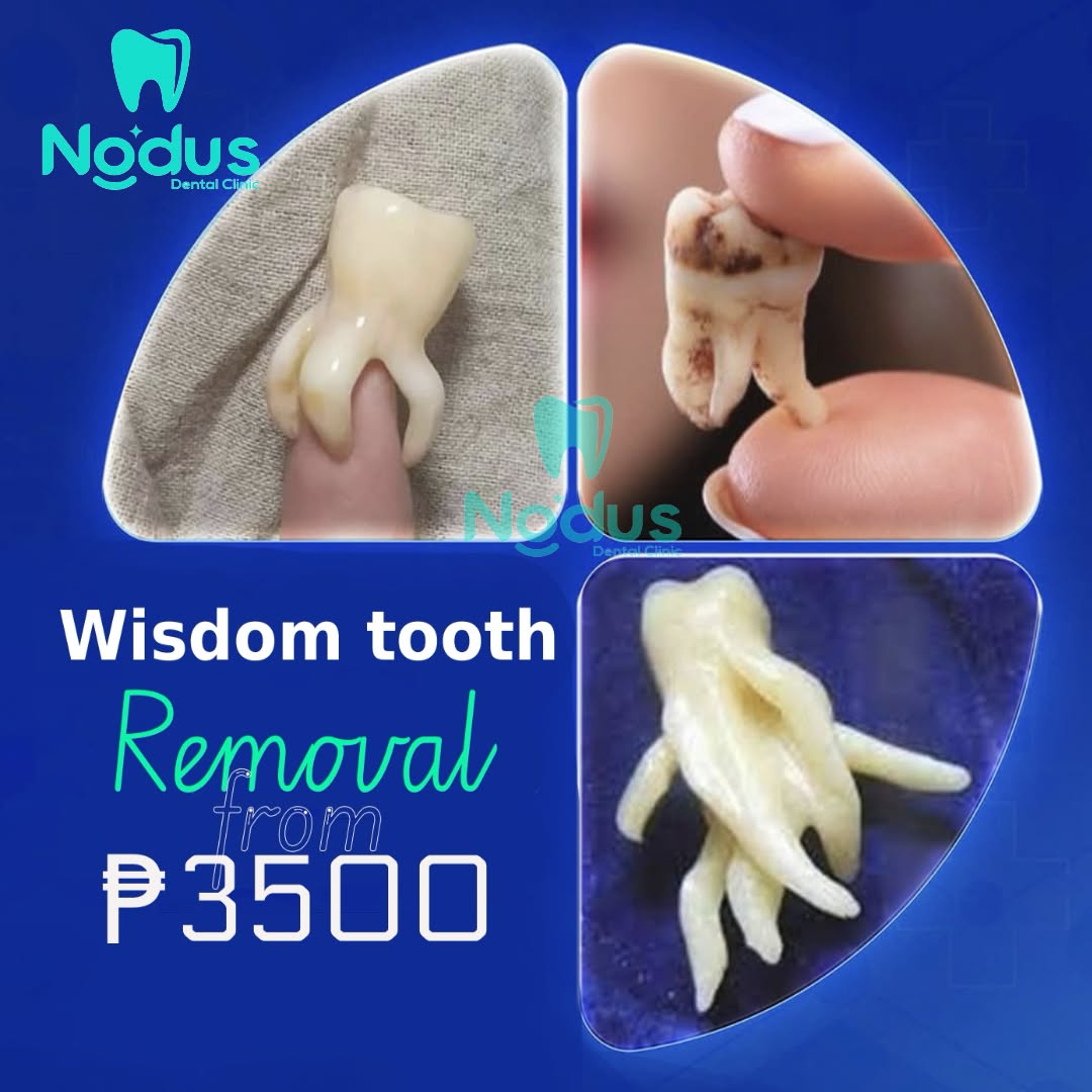 Nodus Dental Clinic Inc Facebook ad: Free consultation >>