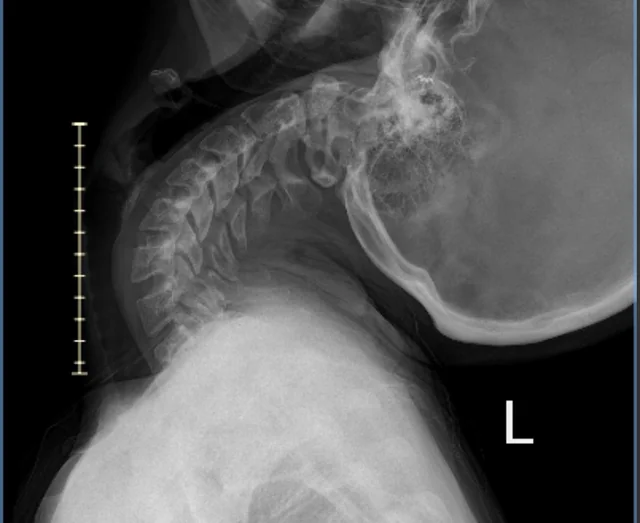 The Inner Ear Report Facebook ad: Read This If You Had Whiplash And Now Have Tinnitus And…