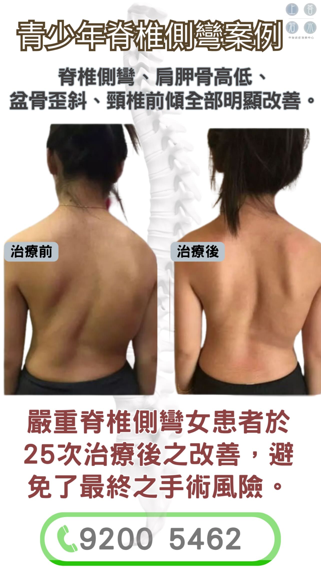 上善若水中醫痛症理療中心 Mercy Chinese Medicine Clinic 筋膜痛症 Chronic Pain Treatment Facebook ad