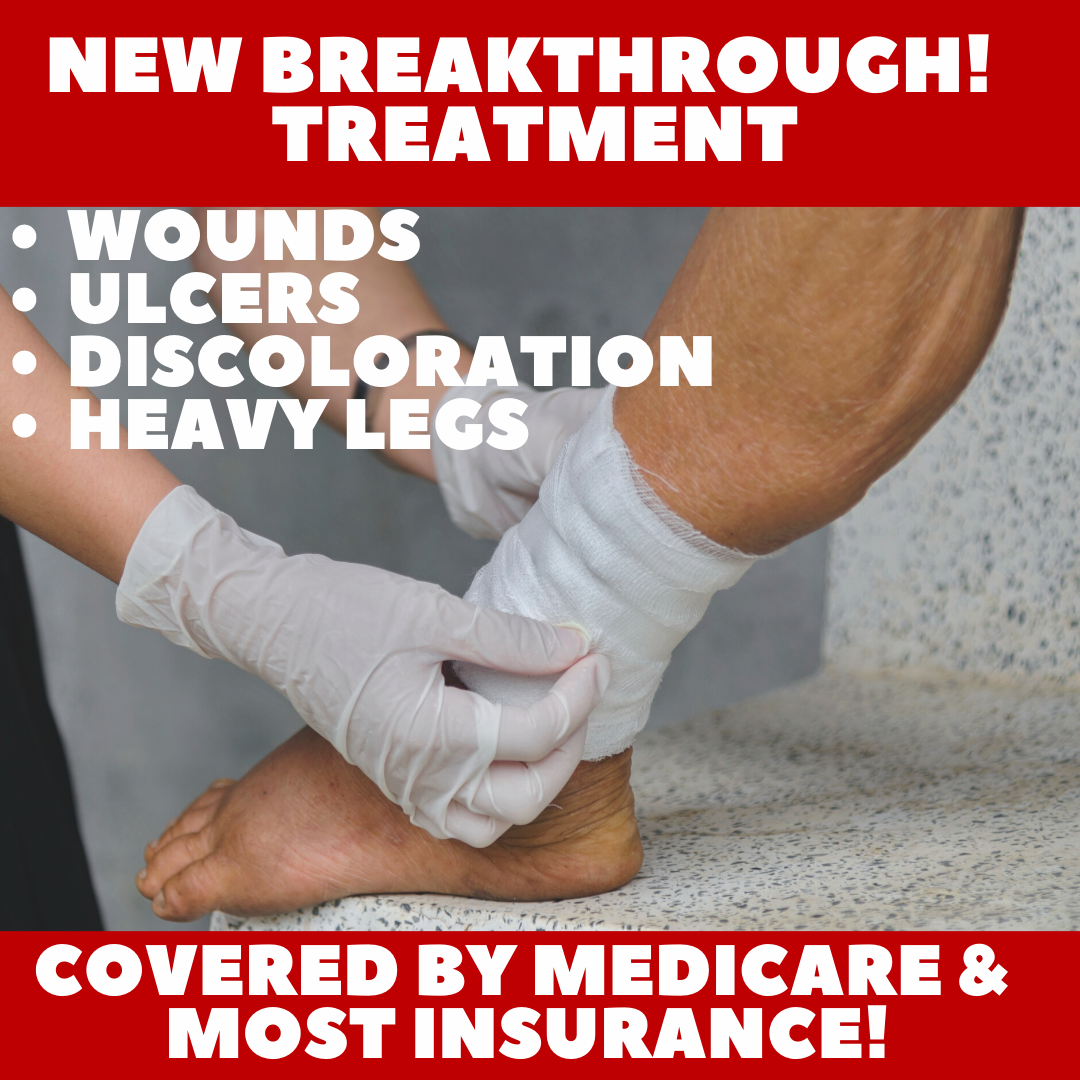 Renew Vein & Vascular Facebook ad