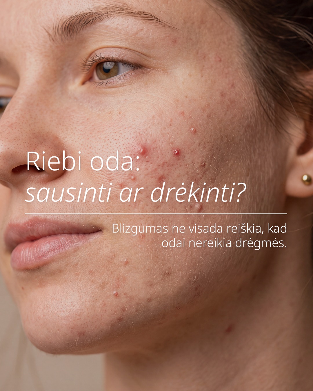 Sebamed Lietuva Facebook ad: Sausinti ar drėkinti?