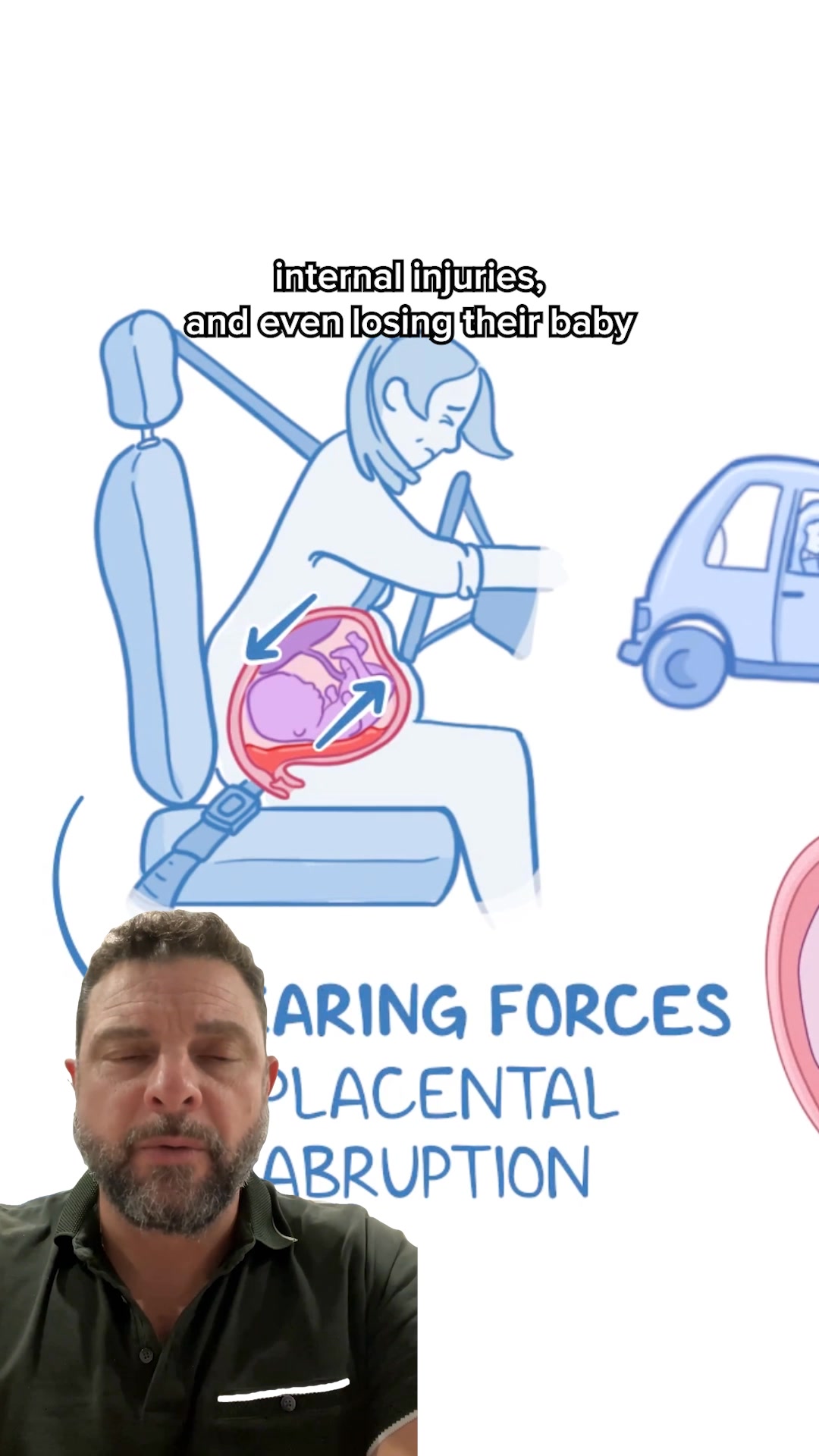 MimiBelt Facebook ad: Protect Your Little One