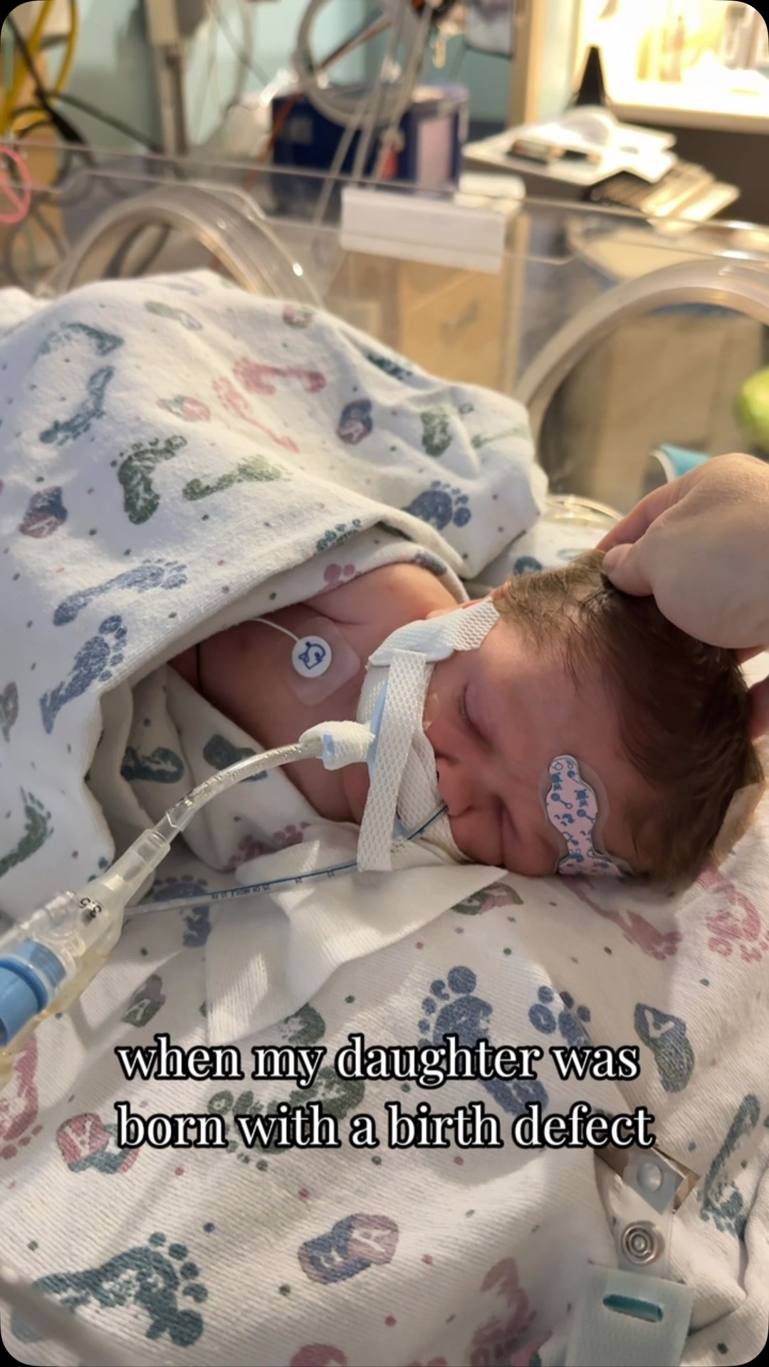 Blair Rosales Facebook ad: When Letty was born with congenital diaphragmatic hernia…