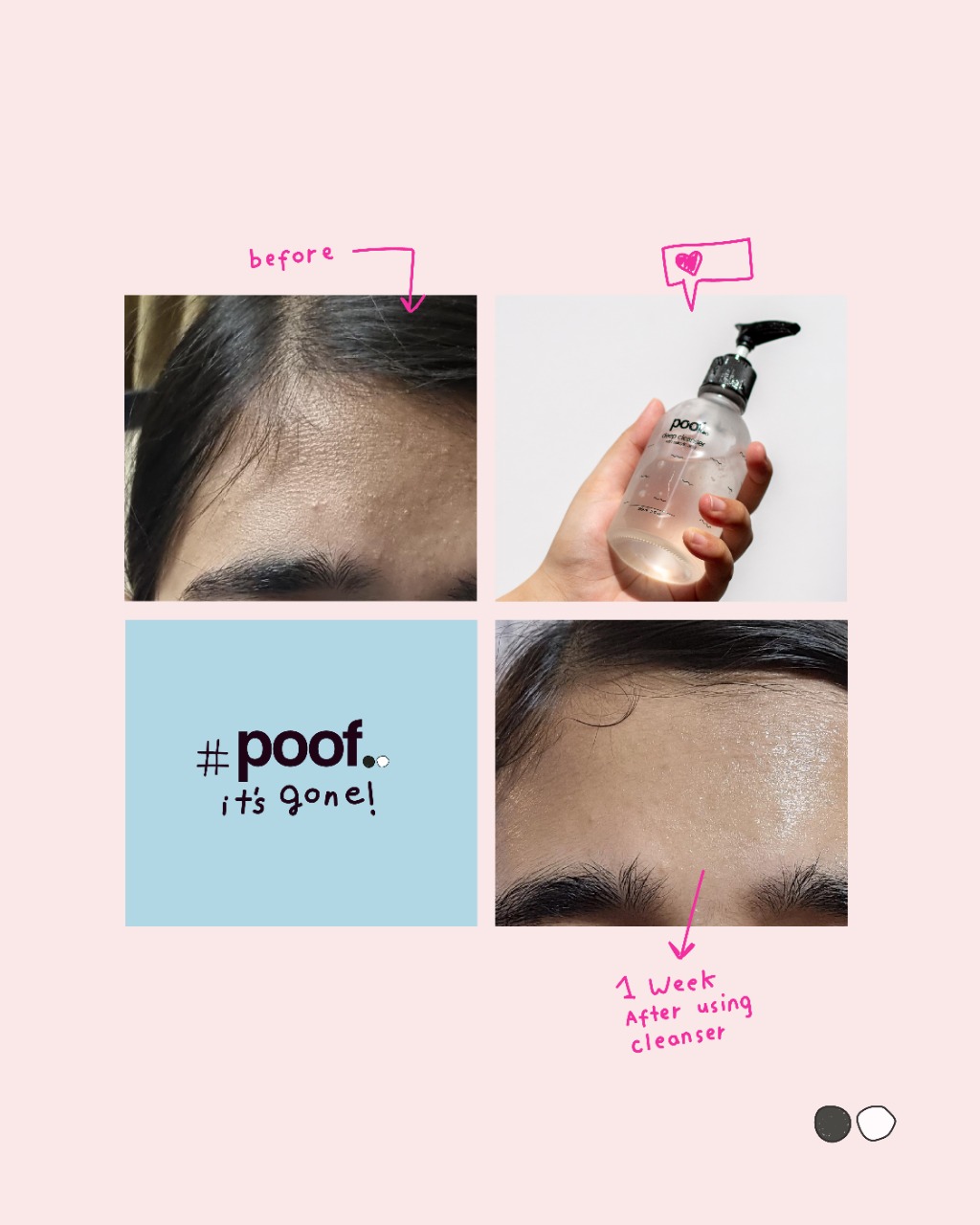 Poof Off Facebook ad: Deep Cleanser w/ Salicylic Acid