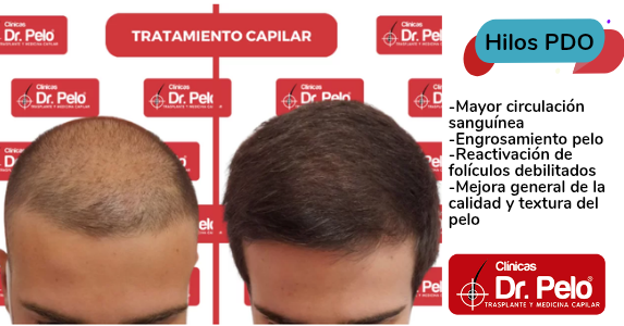 Clinicas Dr Pelo Facebook ad