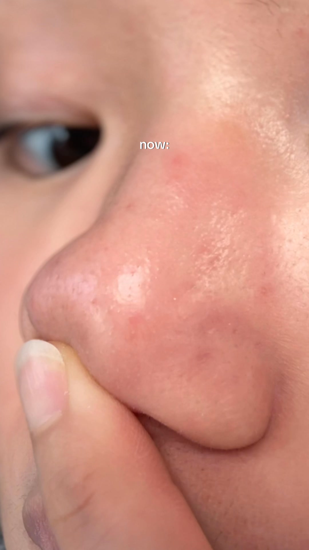 SKIN1004 Facebook ad from Jun 12, 2026