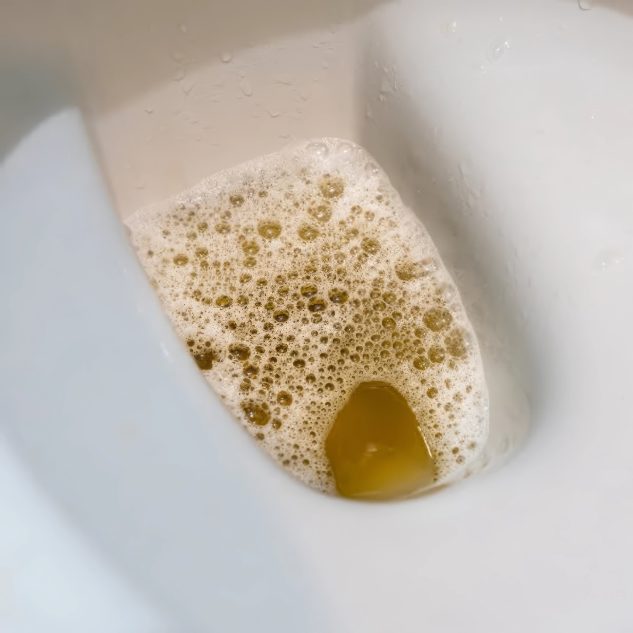 Nutritionist - Carolyn Hurst Facebook ad: Find out what's actually making your filters leak