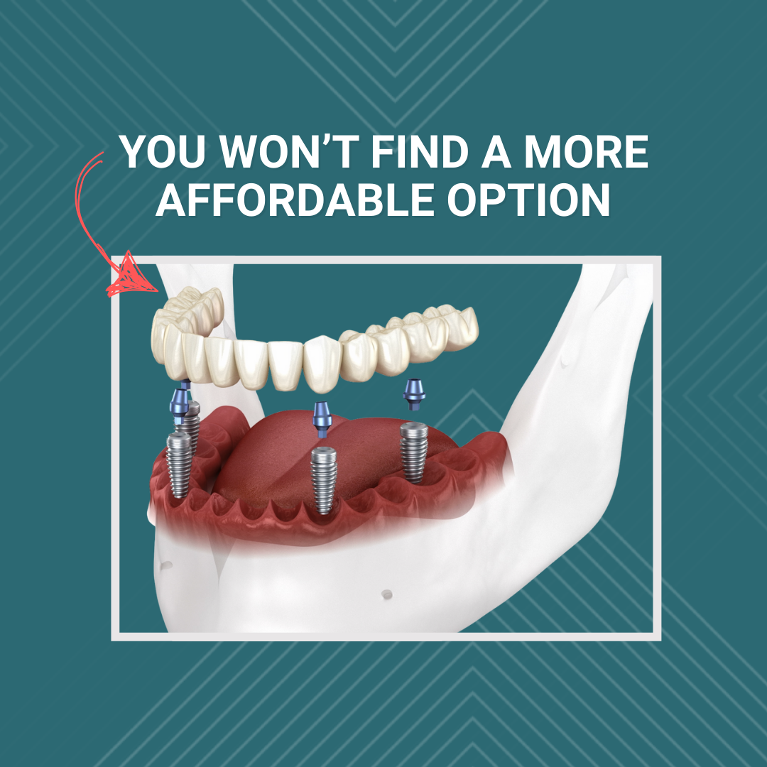 Dental Arts of Catoosa Facebook ad: New Teeth. One Day.