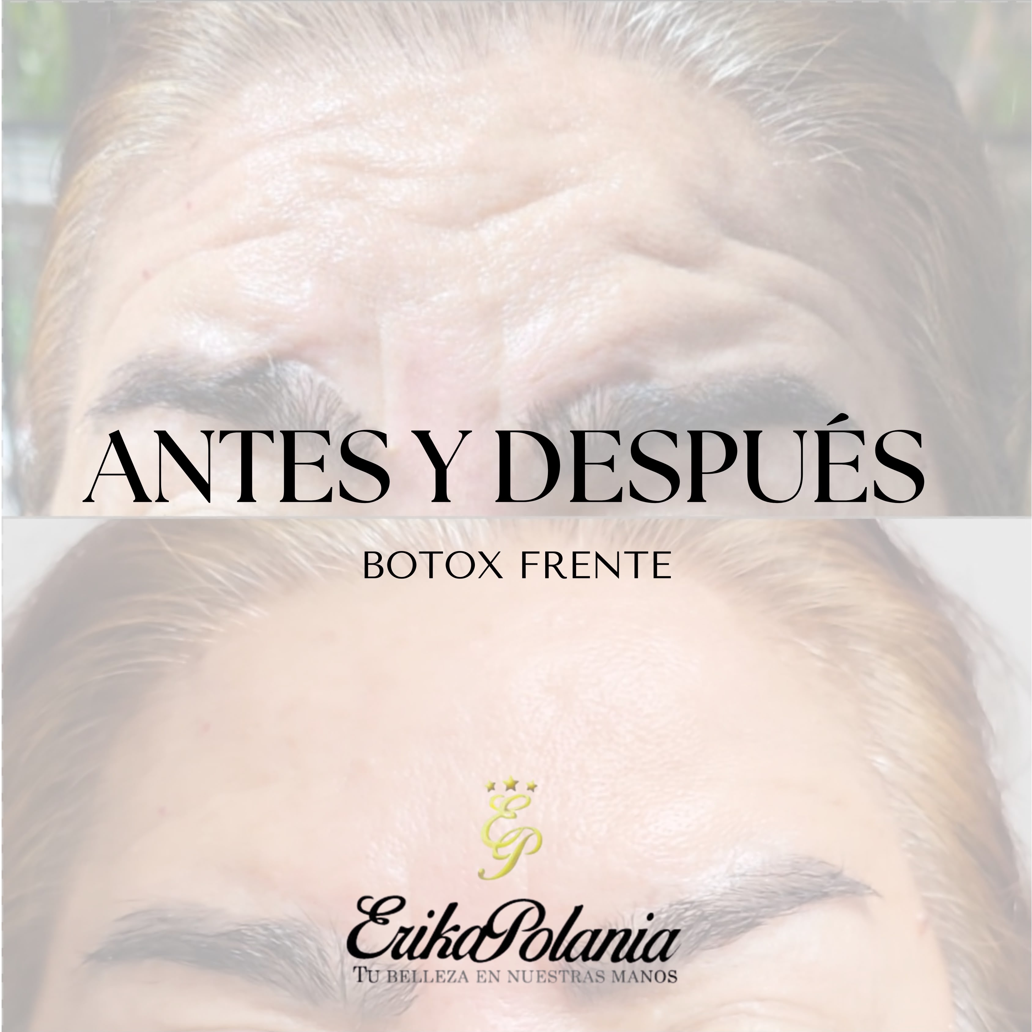 erikapolaniaciudades Facebook ad: ¡Tu frente también merece verse descansada, suave y…