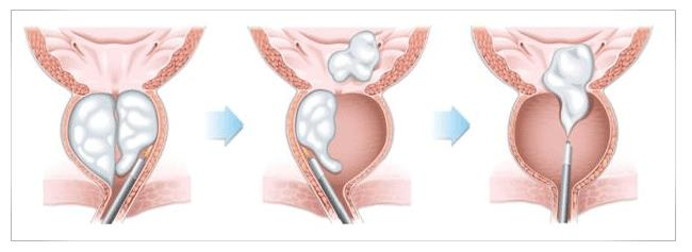 Men's Health Insider Facebook ad