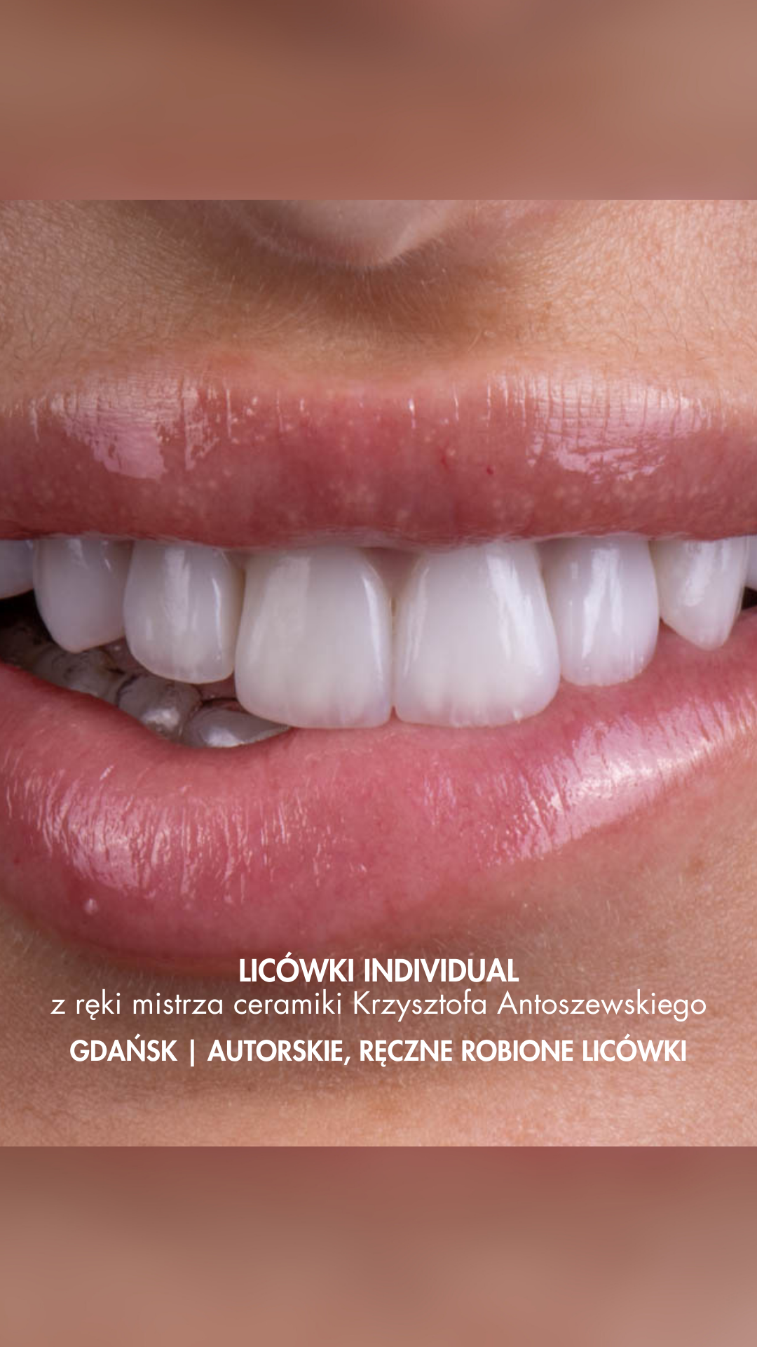 Dual Dental Clinic Facebook ad: Nowe zęby to ogromna odpowiedzialność.