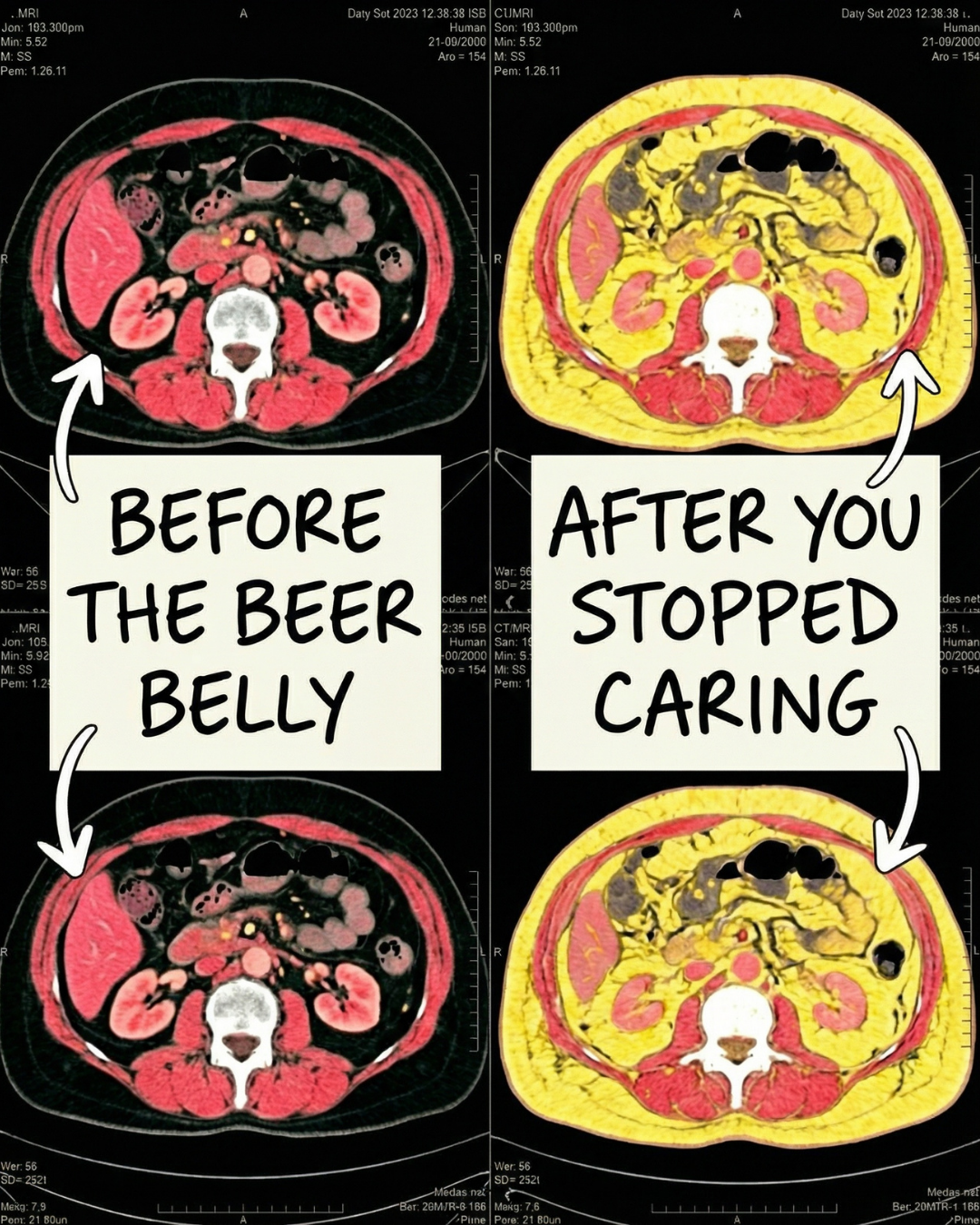 Mark Wilson Facebook ad: Struggling with a Beer belly? Read this