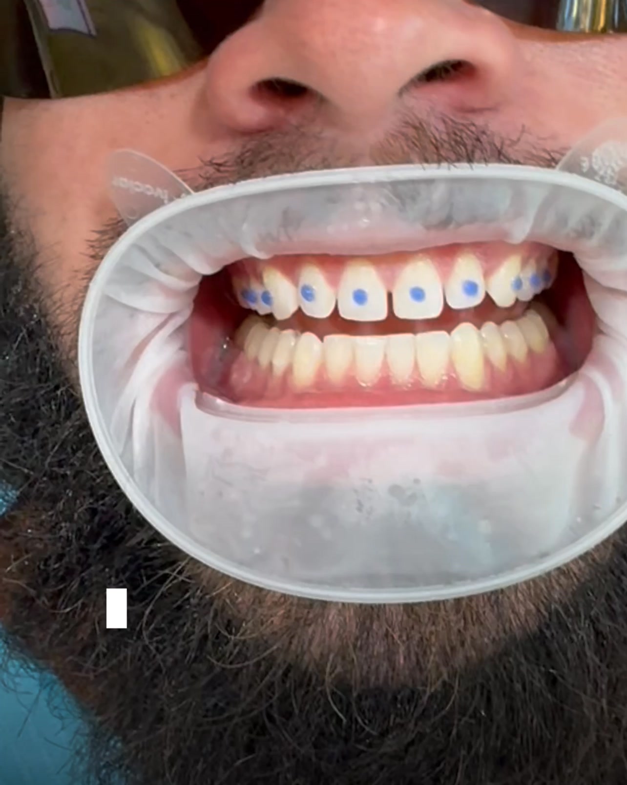 Dental Boutique Facebook ad from Jun 18, 2026