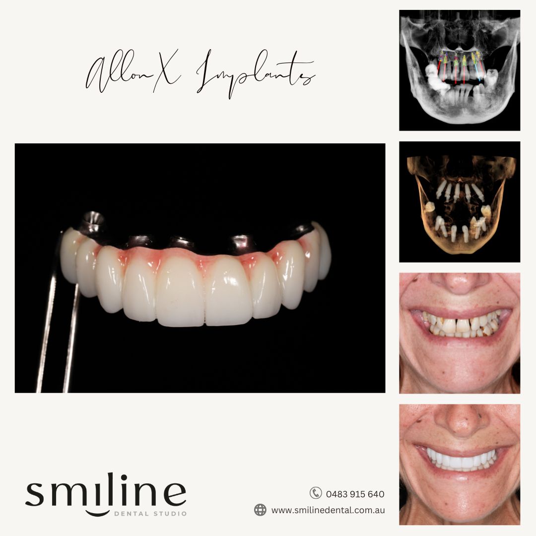 Smiline Dental Facebook ad