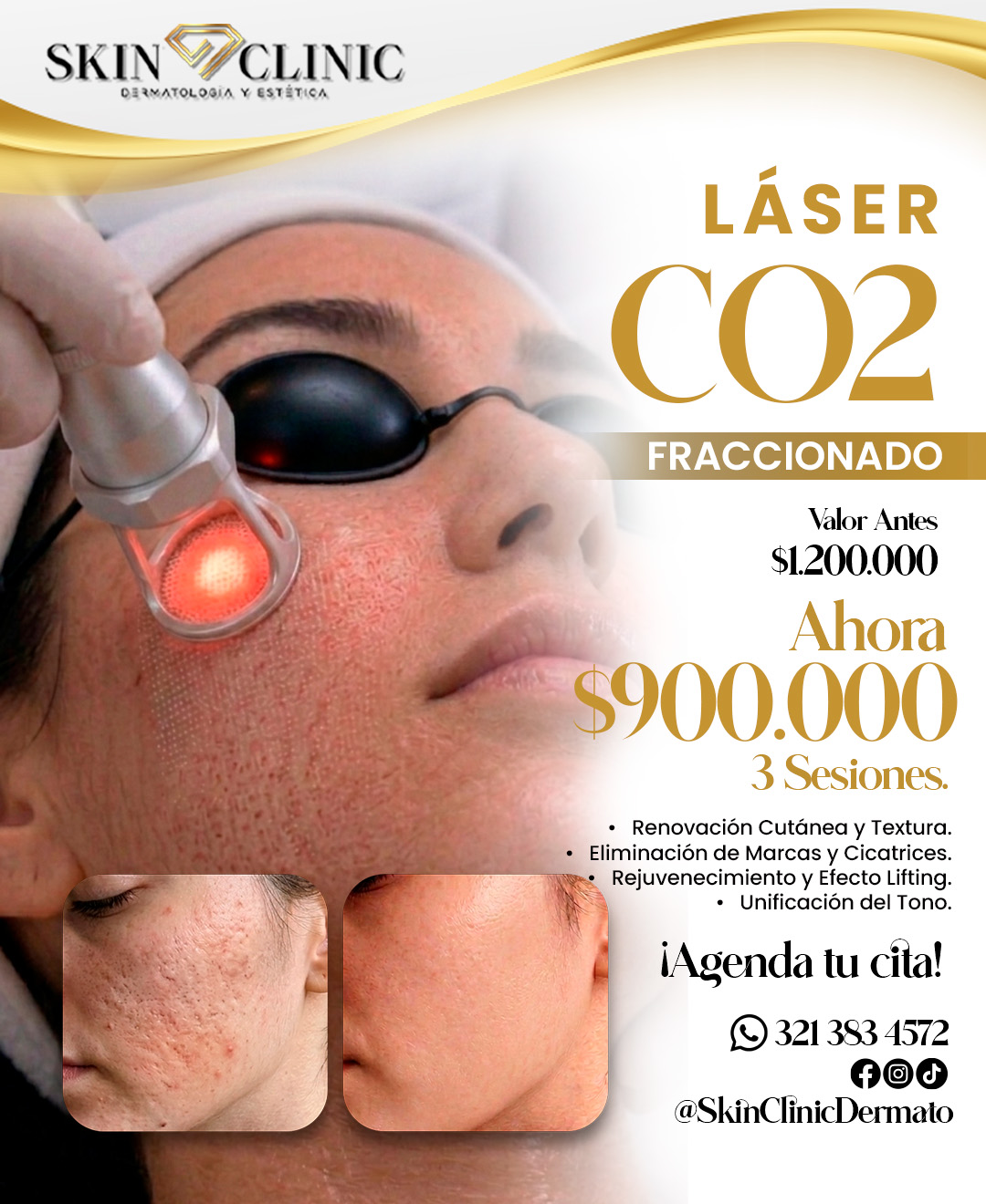 Skin Clinic Dermatología y Estética Facebook ad: ¡PROMO IMPERDIBLE EN SKIN CLINIC!