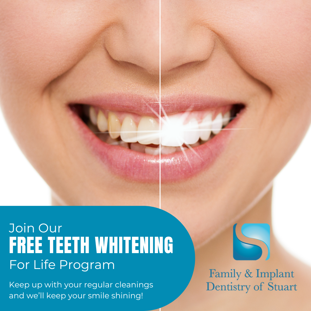 Family & Implant Dentistry of Stuart Facebook ad: Get Free Teeth Whitening for Life!