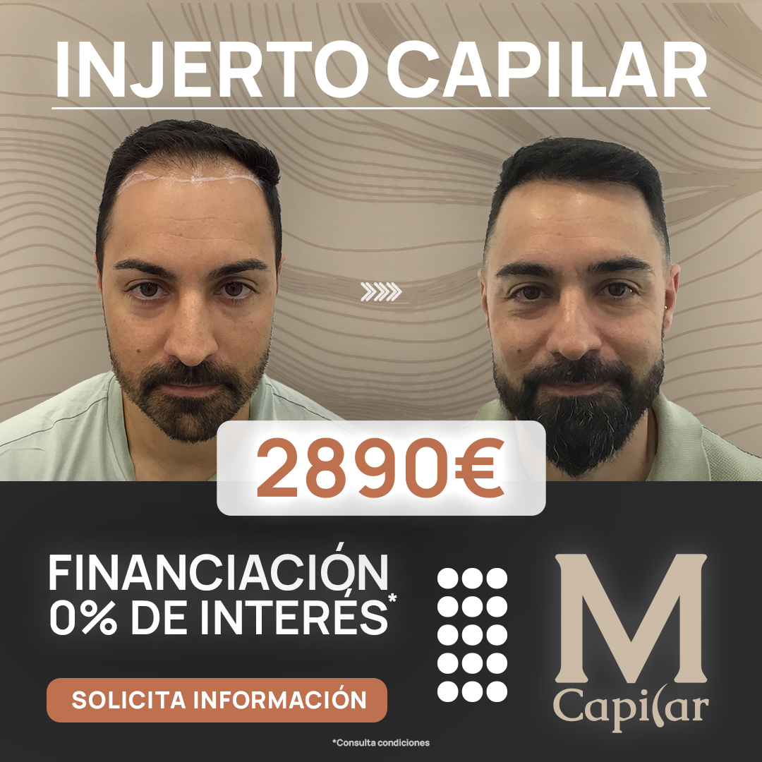 MCapilar Facebook ad