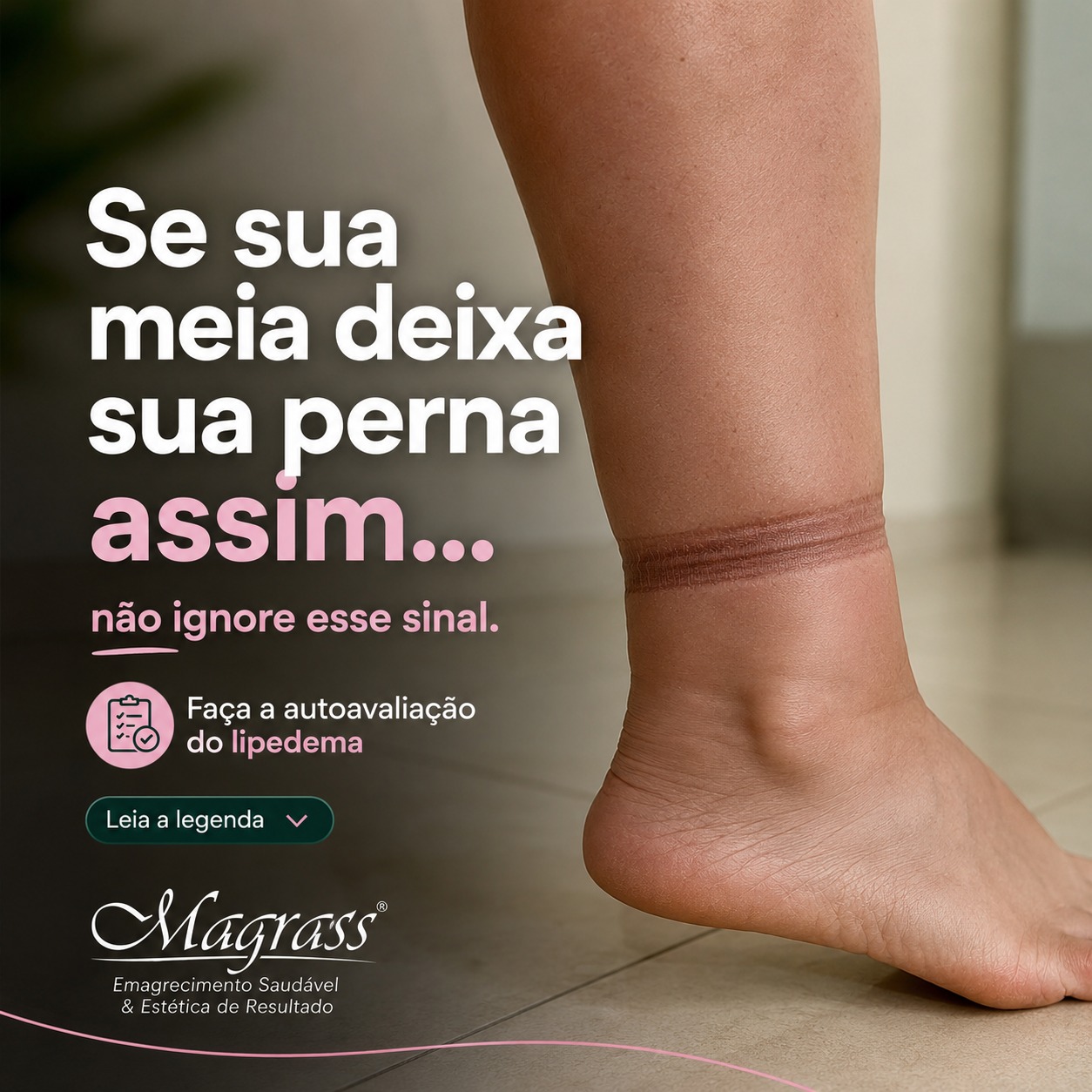 Lipedema Campo Grande Facebook ad: VOCÊ TEM LIPEDEMA?