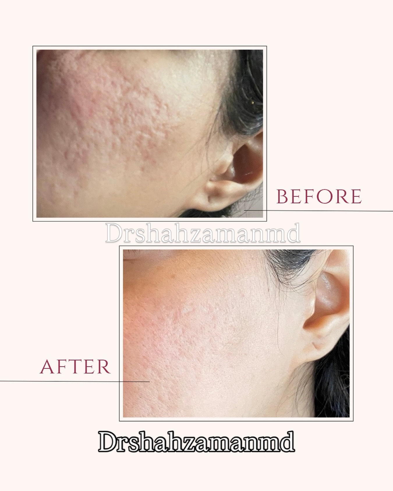 Dr shahzaman Facebook ad