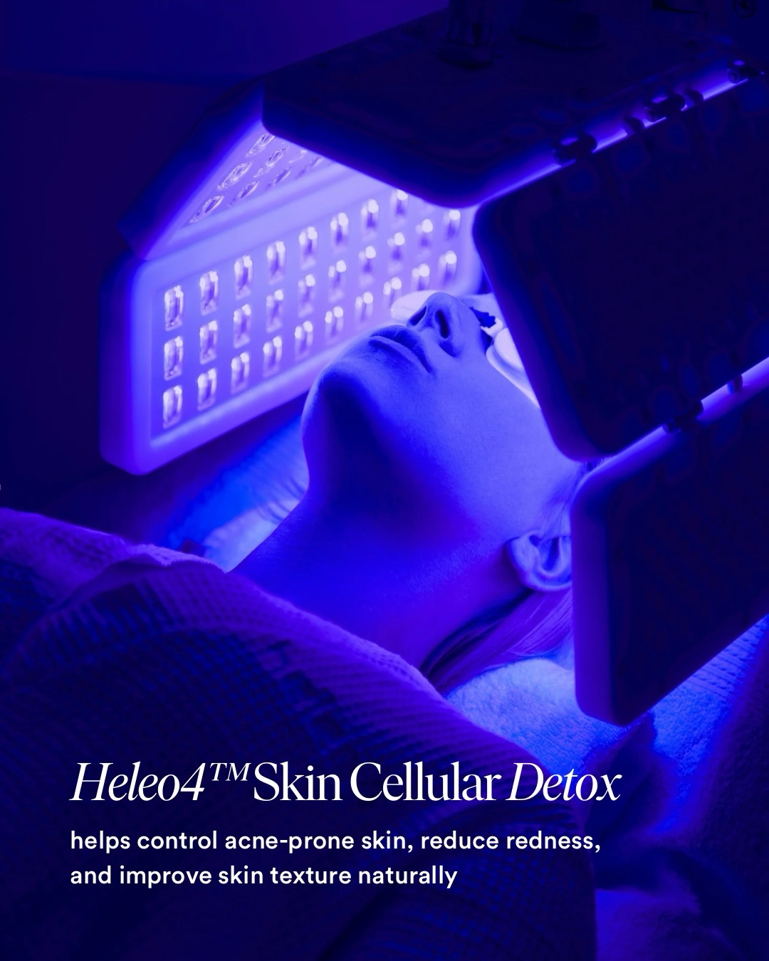 Heleo4 Arabia Facebook ad: A 30-year-old patient with acne-prone skin achieved…