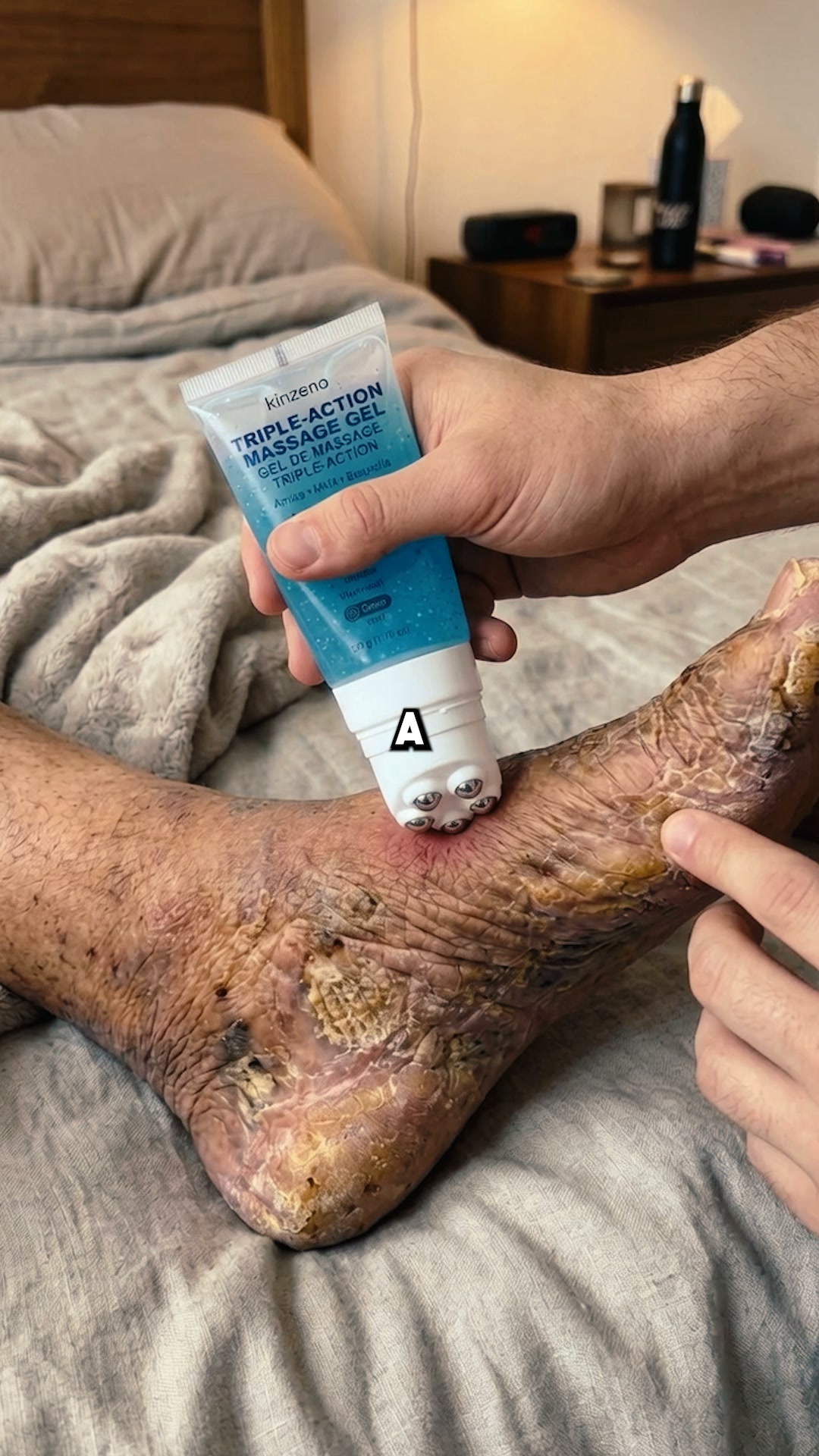 Kinzeno Facebook ad: Burning Feet Waking You Up At 3 AM? This 30-Second Bedtime…