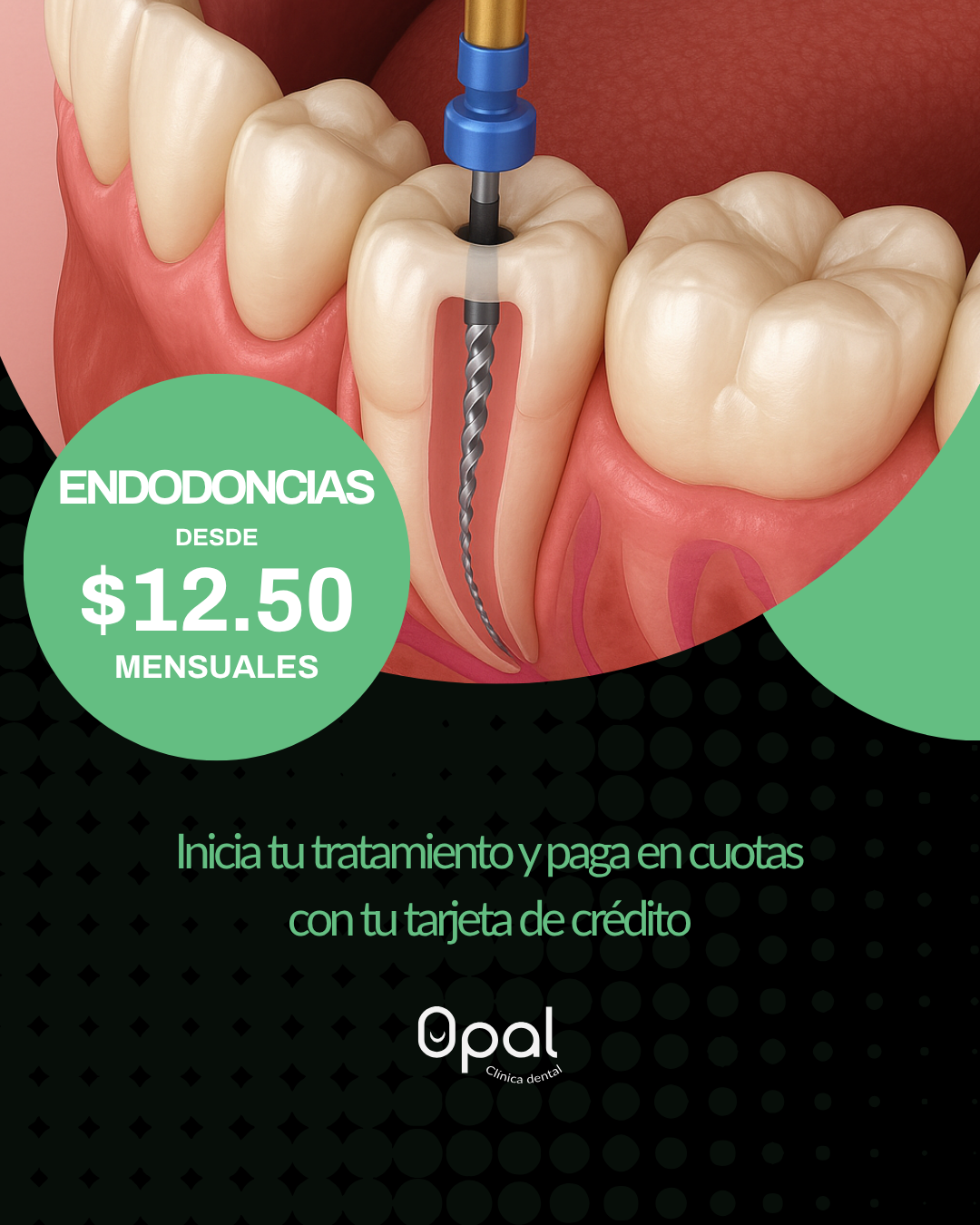 Opal Clínica Dental Facebook ad