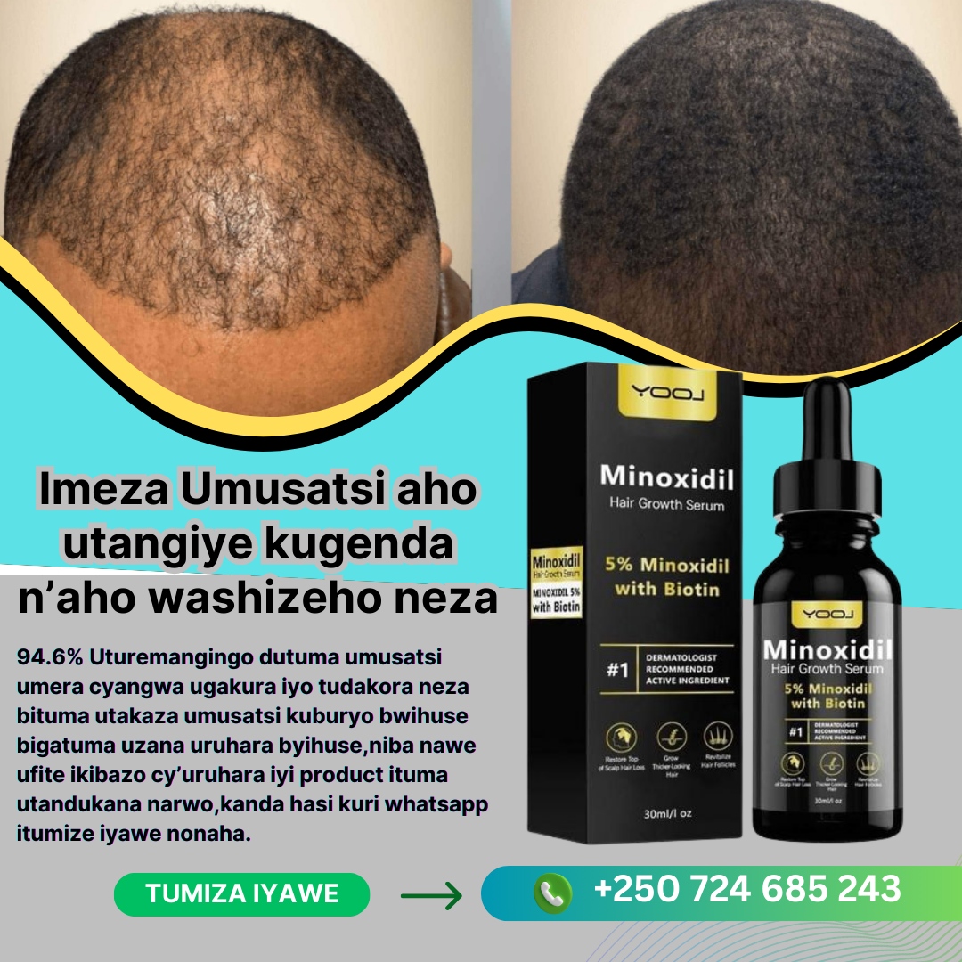 Kigali Skinpop hub Facebook ad: 1.Minoxidil5% irimo Biotin ikuza umusatsi ikanarinda…