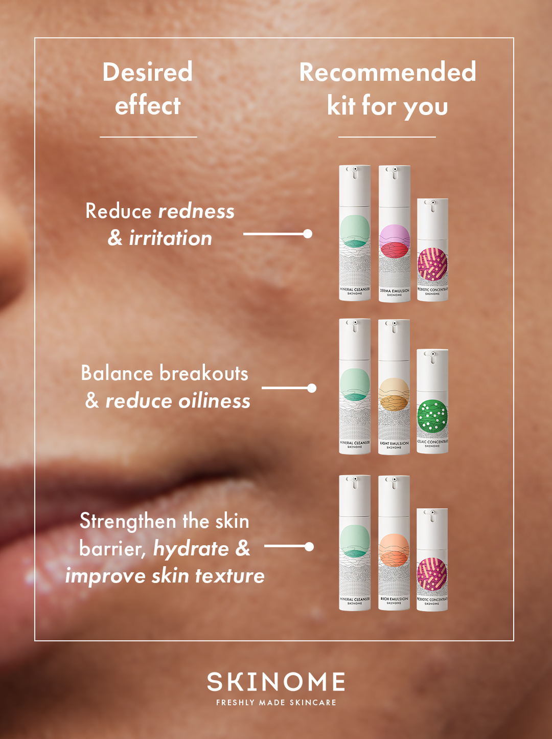 Skinome Facebook ad