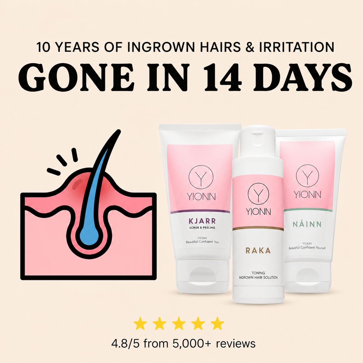 YIONN Facebook ad: What if it isn't your sensitive skin?