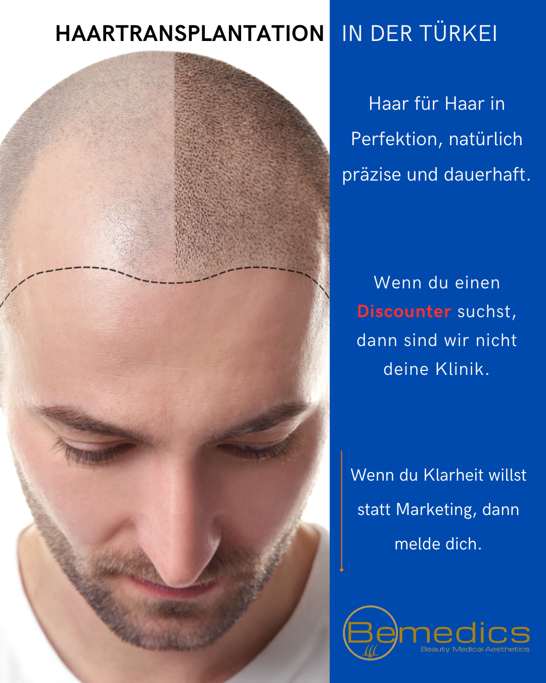 Bemedics Facebook ad from Apr 24, 2026