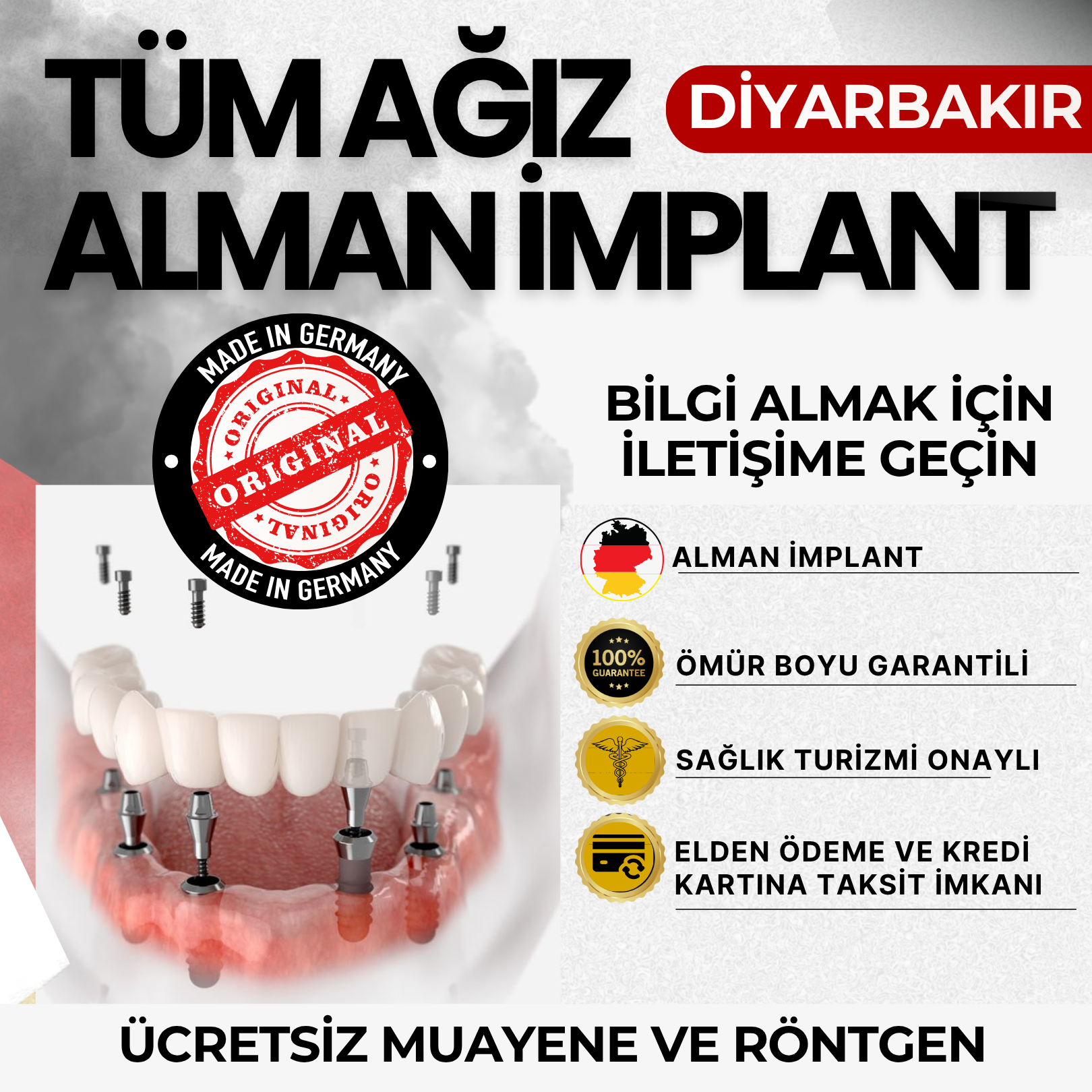 Istanbul diş klinikleri Facebook ad: TÜM AĞIZ ALMAN İMPLANT HAKKINDA BİLGİ ALMAK İÇİN İLETİŞİME…