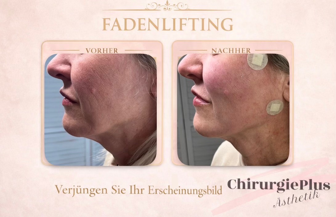 ChirurgiePlus Facebook ad: Dr. Miculik ChirurgiePlus