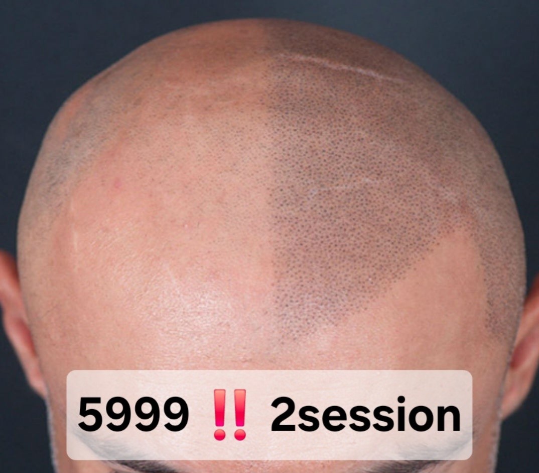 Brow Expert -Binan- Facebook ad: FOR JUST 5999 ONLY