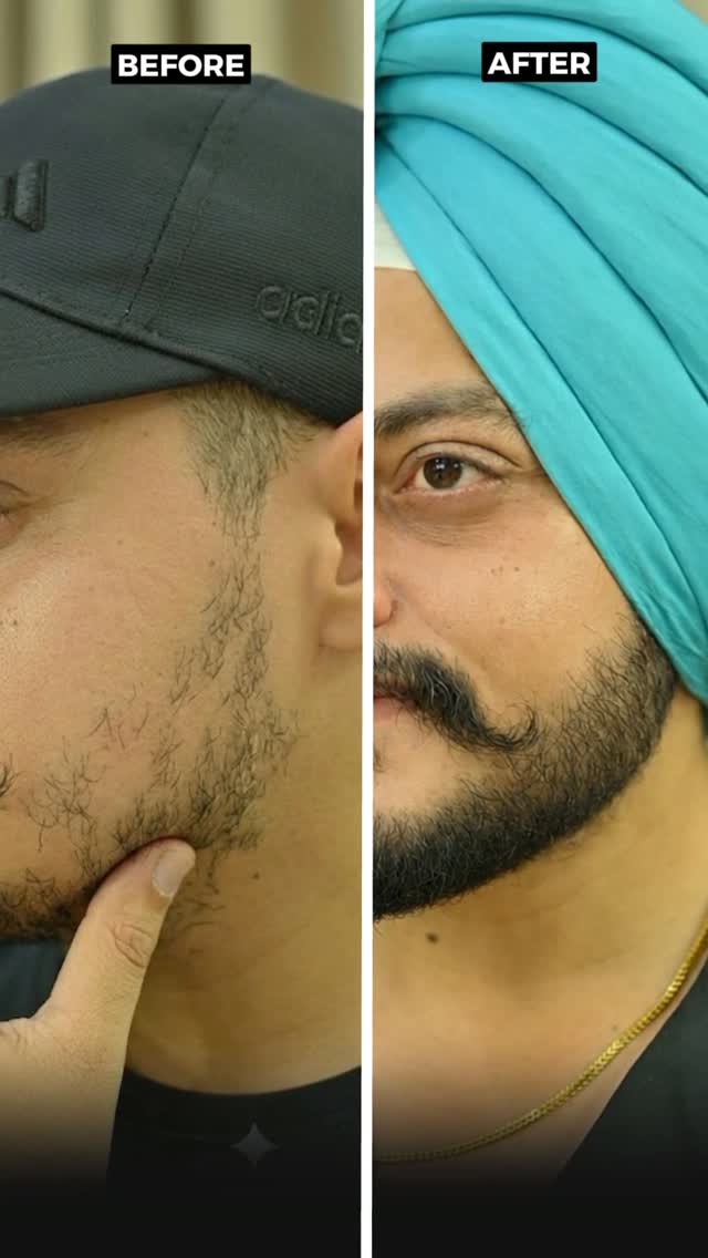 Bare Anatomy Facebook ad: Je tuhadi beard vi patchy aa te tusi…