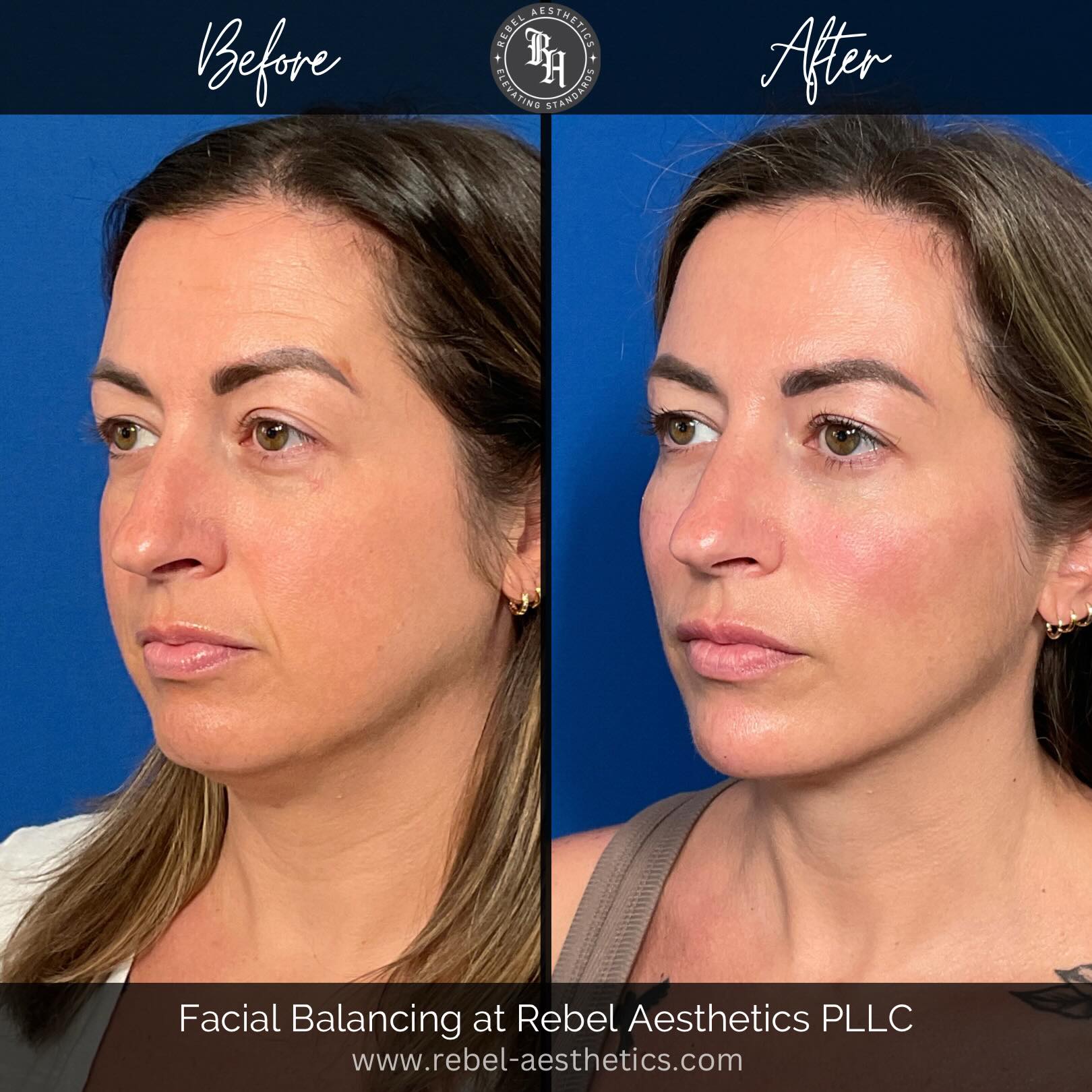 Rebel Aesthetics PLLC Facebook ad: When patients ask for my recommendations and ACTUALLY…
