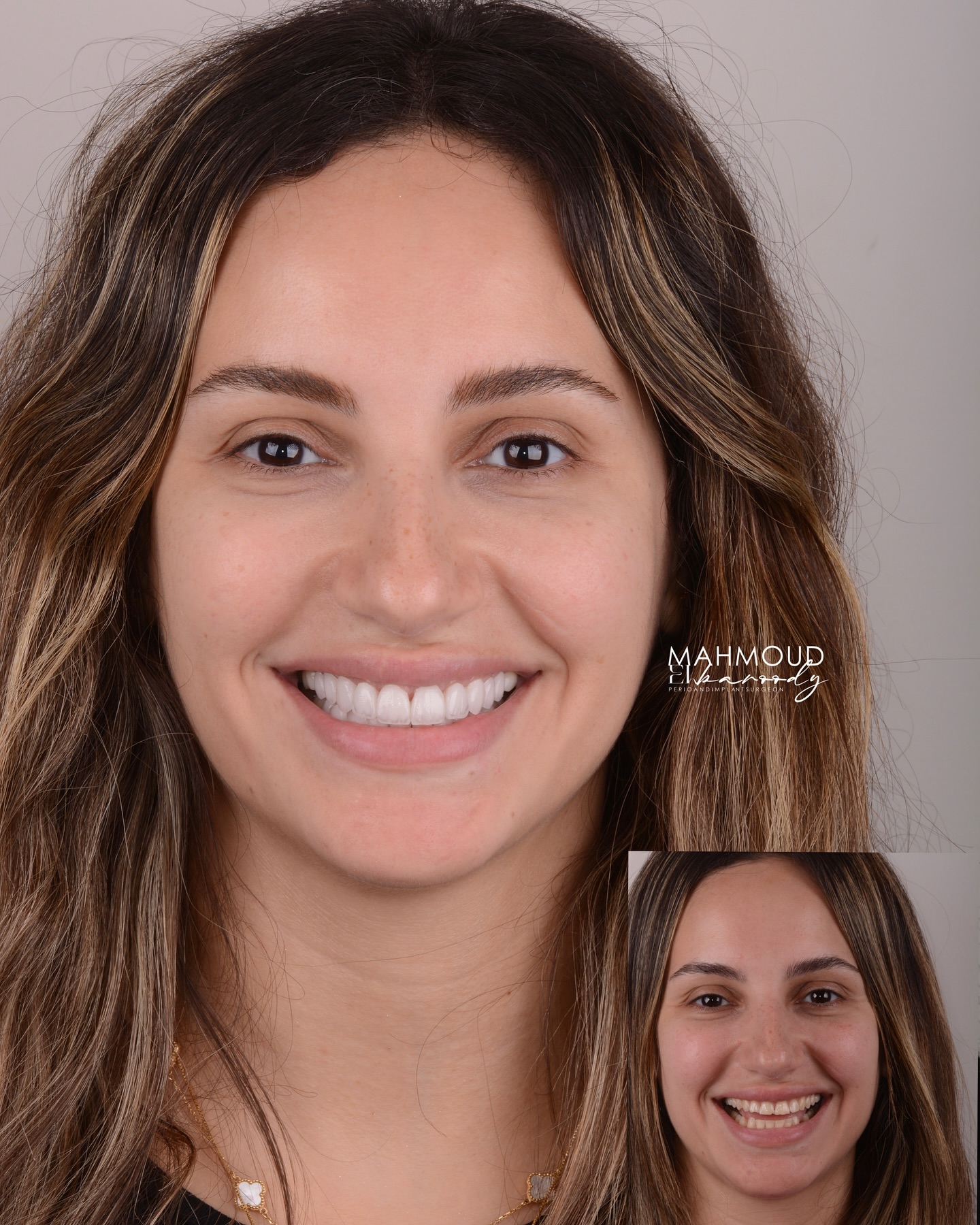 البارودي لطب الأسنان Facebook ad: Just a smile?