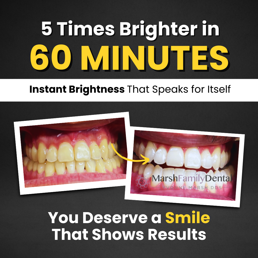 Marsh Family Dental - Yvonne R. Marsh, DDS Facebook ad: Whiten Your Smile in Just 60 Minutes