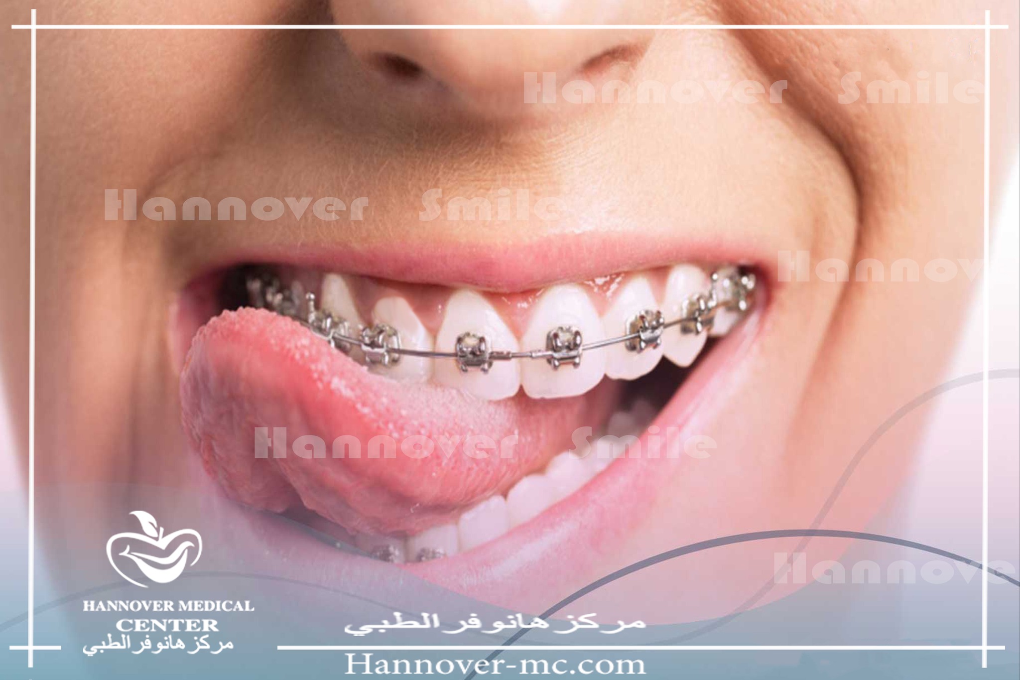 مركز هانوفر الطبي - الخان بالشارقة Facebook ad