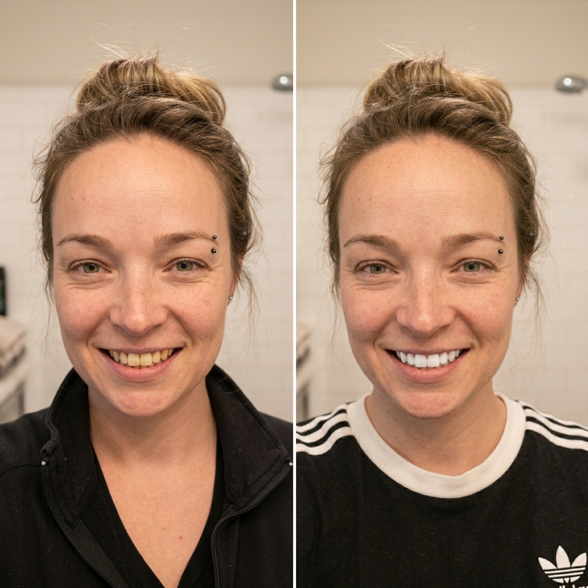 EBS Insider Facebook ad: The 2-Minute Whitening Trick That Works