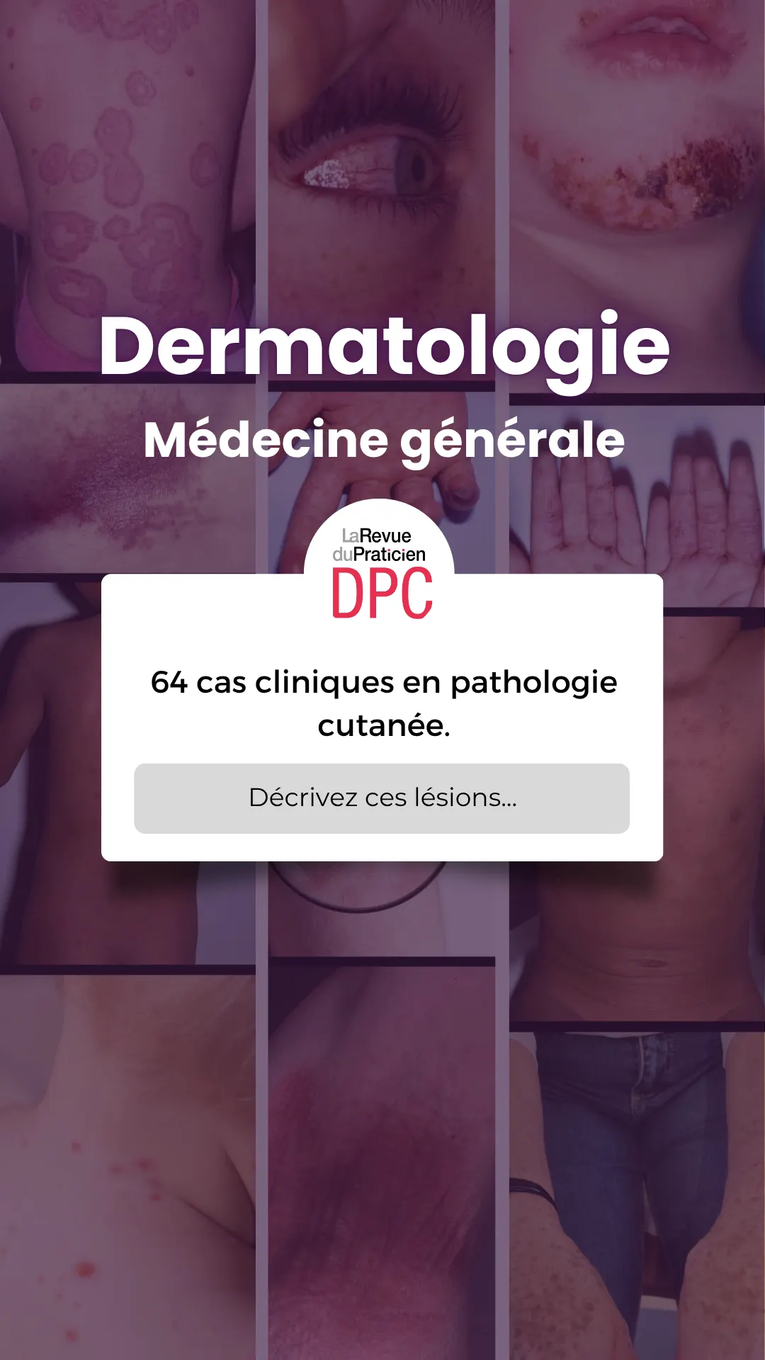 La Revue du Praticien DPC Facebook ad