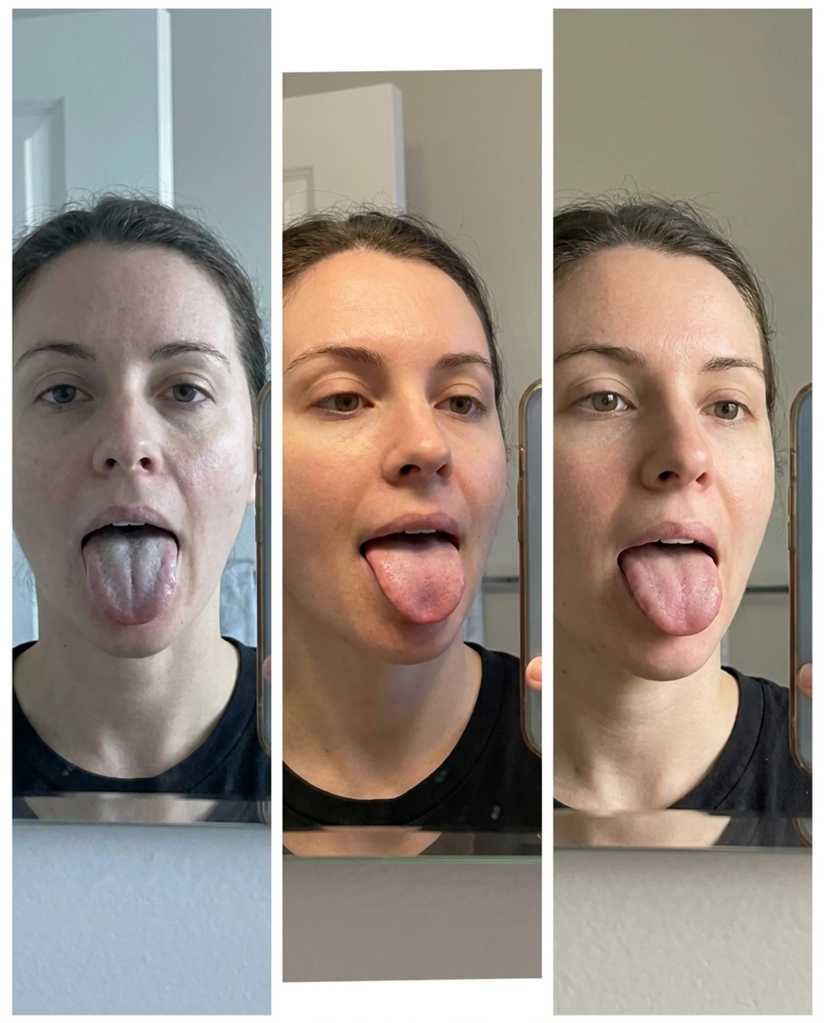 Oral Microbiome Health Facebook ad