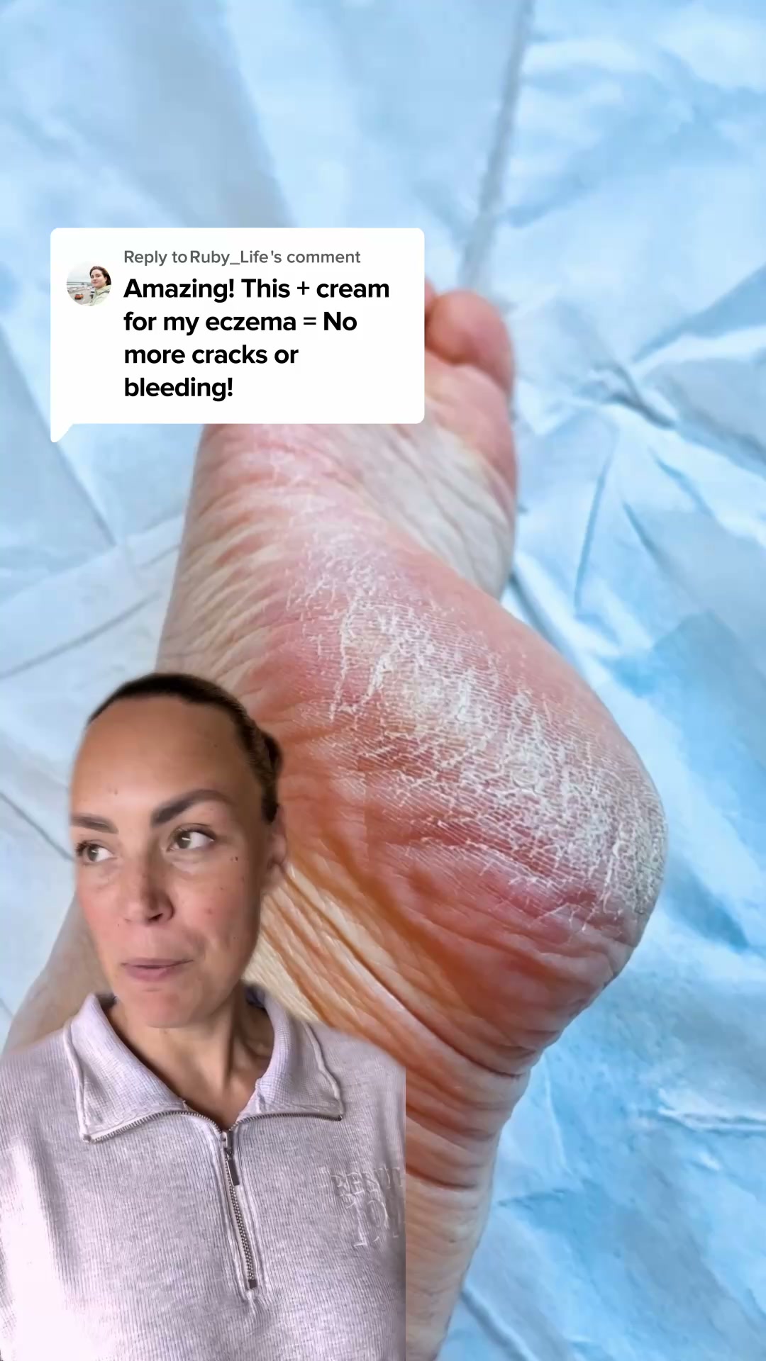 Nuvé Facebook ad: Baby soft feet in 5 minutes flat